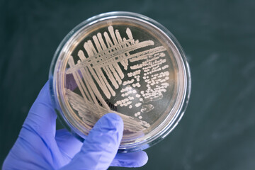 Canvas Print - Close-up, the doctor holds in his hand a closed Petri dish with colonies of dangerous bacteria. The scientist obtained a pure culture of bacterial colonies.