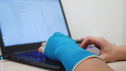 Male hand wrapped in fiberglass plaster cast is coding program code on a laptop, close up copy space. Programmer with broken wrist works in office or at home