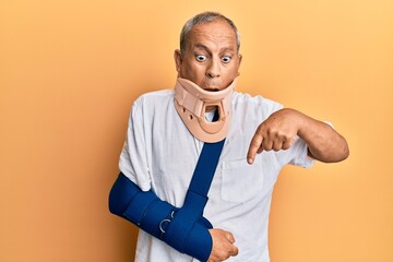 Canvas Print - Handsome mature senior man wearing cervical collar and arm on sling pointing down with fingers showing advertisement, surprised face and open mouth