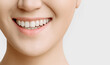 © Асель Иржанова - smile of a woman with beautiful white teeth close-up on a white background copy space.the concept of smooth healthy teeth