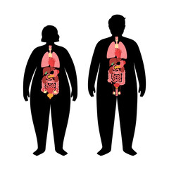 Wall Mural - Organs in obese human body