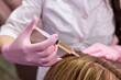 © alfa27 - female doctor trichologist conducts mesotherapy or plasma therapy to young woman patient. treatment of alopecia. hair loss, alopecia, pruritus, burning head or seborrhea. close-up, focus on syringe