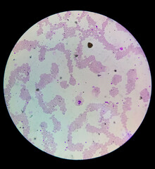 Sticker - Microscopic view of hematology slide. RBC. WBC. closeup. Stained slide. Smear. Platelet, blood film