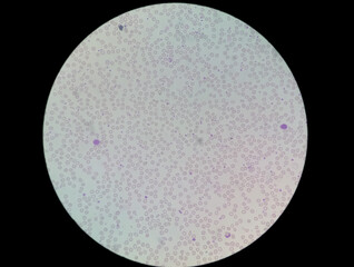 Wall Mural - Microscopic view of hematology slide in laboratory. Stained slide. close up