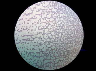 Sticker - Microscopic view of hematology slide. RBC. WBC. closeup. Stained slide. Smear. Platelet