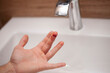 © Артем Барынин - The man cut his finger. A cut. Blood flows from the finger