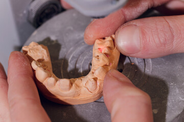 The process of making a dental prosthesis in a dental laboratory.