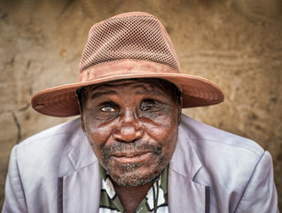 african blind man