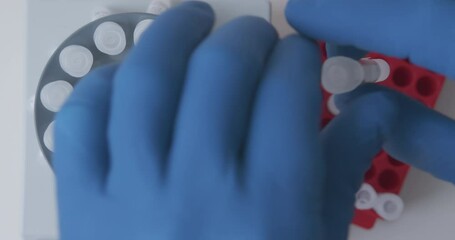 Wall Mural - lab technician loads the samples with the sample into the laboratory centrifuge