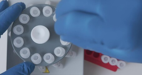Wall Mural - lab technician loads the samples with the sample into the laboratory centrifuge