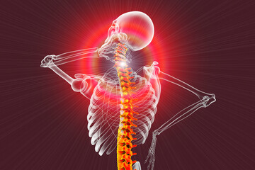 Sticker - Neck pain, illustration