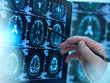 © Connect Images - Doctor viewing brain scans for possible disease or damage in clinic