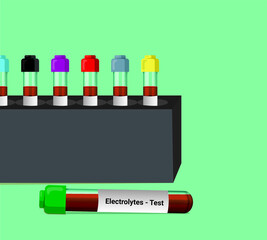 Blood sample for electrolytes test. Blood collection tube with Lithium heparin as an anticoagulant. A medical testing concept with tube vector in the laboratory background.