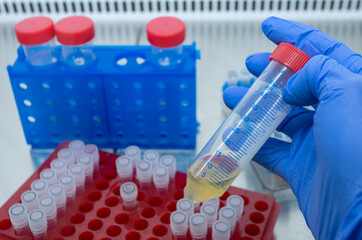 Wall Mural - The scientist holds in his hand a large test tube with a sample of yellow liquid against the background of racks with small test tubes.