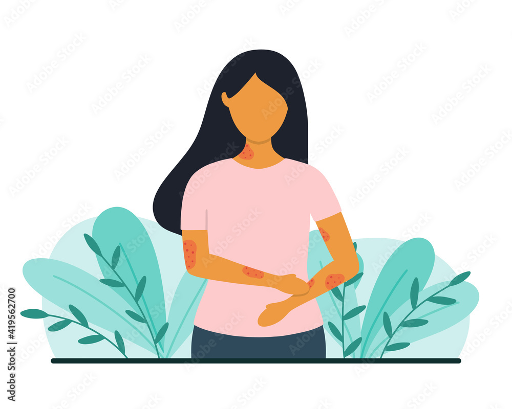 Woman with skin problems. Psoriasis or eczema concept. Flat style ...