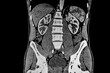 CT SCAN of abdomen showing liver, kidney and the spine. Medical themes.
