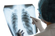 © Андрей Жерновой - A female doctor or radiologist examines a chest x-ray of a patient in a hospital. Pulmonology and cardiothoracic surgery concept. Control and monitoring of diseases of the lungs and respiratory organs