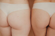 © Liliya Rodnikova/Stocksy - Crop female's butts