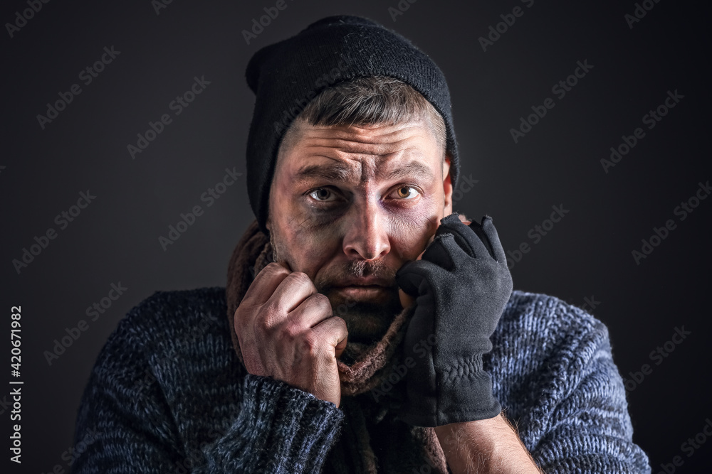 Portrait of poor homeless man on dark background