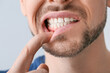 Leinwandbild Motiv Man suffering from tooth ache, closeup