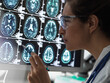© Connect Images - Neurology Diagnosis, Human brain scan on a screen being analysed by a female doctor in a neurology clinic.