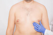 © HENADZY - Plastic surgeon doctor examines the male breast before surgery to reduce breast fat, gynecomastia