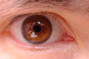 close up of a man eye and healthcare concept