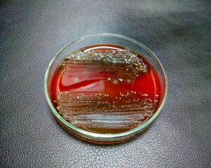 Poster - Petri dish. Microbiological laboratory. Enterobacter colony on blood agar media. Bacterial research