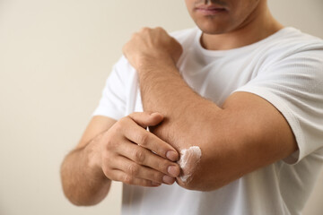 Wall Mural - Man applying cream onto elbow on beige background, closeup