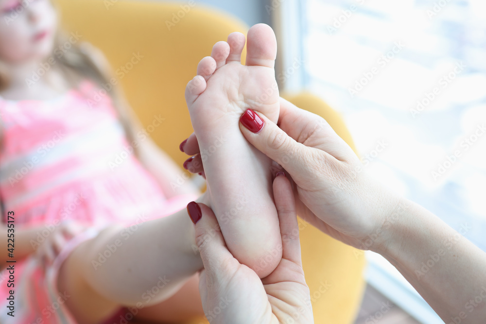 Doctor orthopedist examining feet of little girl closeup - obrazy, fototapety, plakaty 