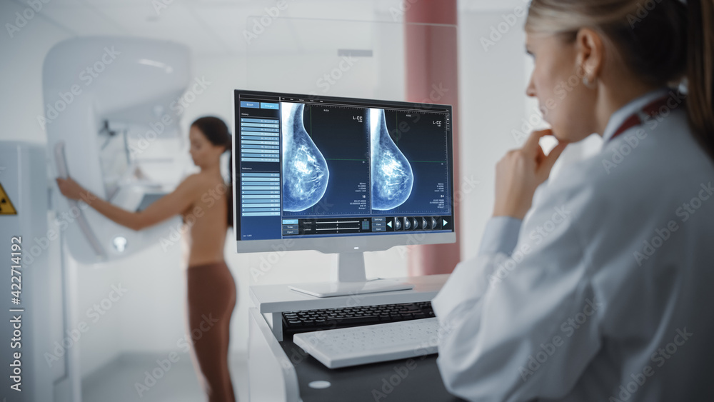 Computer Screen in Hospital Radiology Room: Beautiful Multiethnic Adult Woman Standing Topless Undergoing Mammography Screening Procedure. Screen Showing the Mammogram Scans of Dense Breast Tissues. - obrazy, fototapety, plakaty 
