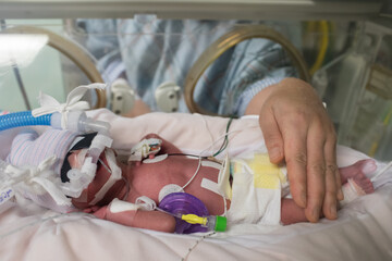 Mother touching premature newborn baby in incubator