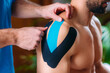 © Microgen - Therapist Taping Man’s Shoulder with Elastic Therapeutic Kinesiology Tape