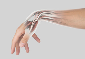 wrist muscle pain