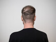 One young caucasian male facing away with the back of his head showing a bald patch. A balding concept that shows clear signs of hair loss in the early stages. White background with room for text.
