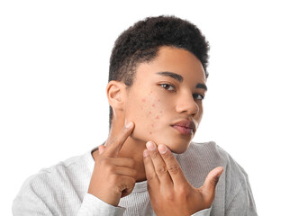 African-American teenage boy with acne problem on white background