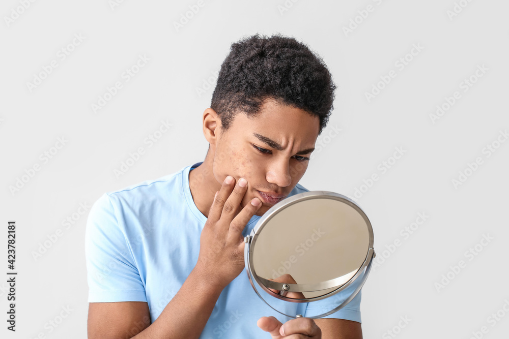 African-American teenage boy with acne problem on light background