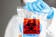 A Woman Researcher Is Holding A Clear Plastic Bag With Biohazard Logo Printed On. The Bag Contains, Potentially Dangerous Biological Specimens. Scientists Discard These Waste In These Labelled Bags.