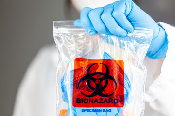 a woman researcher is holding a clear plastic bag with biohazard logo printed on. the bag contains, 