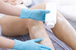 © klavdiyav - female legs before hair removal with  sugaring procedure in beauty salon