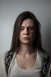 © perfectlab - Domestic violence, abuse woman with bruise on face