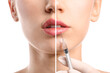 © Pixel-Shot - Young woman before and after lips enhancement, closeup