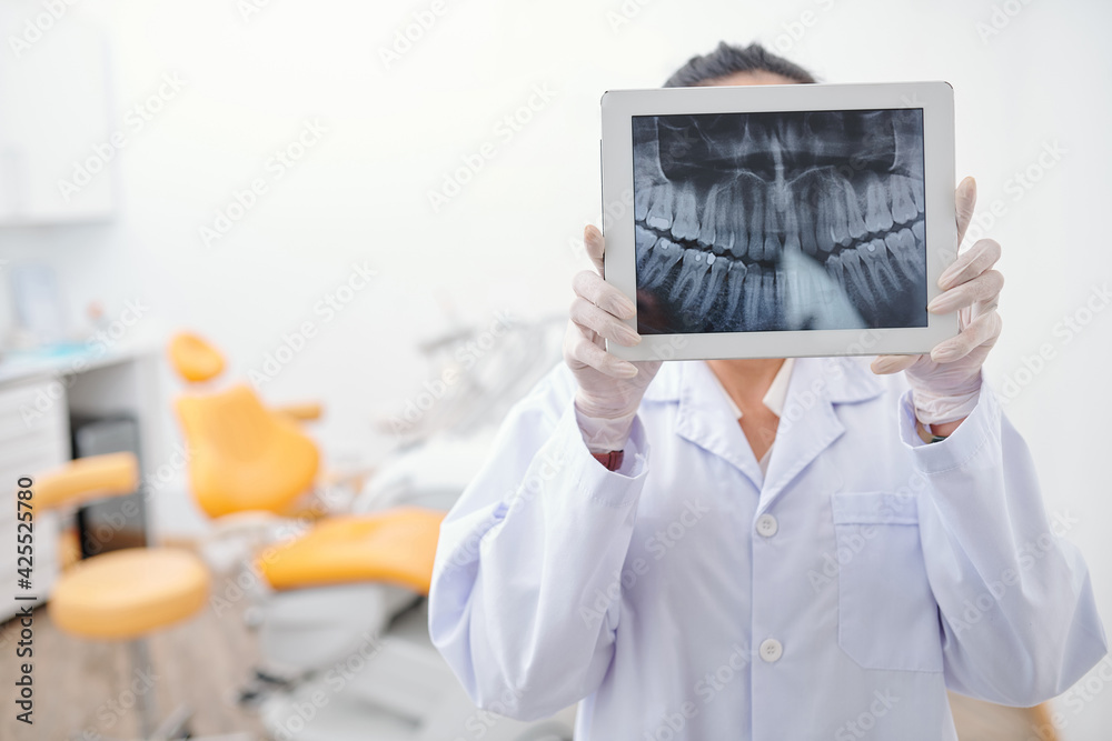 Dentist holding digital tablet with teeth x-ray on screen and looking for any inflammation - obrazy, fototapety, plakaty 