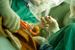 a surgeon performs an operation using a surgical microscope, close-up of a surgeon's assistant's hand with a syringe.