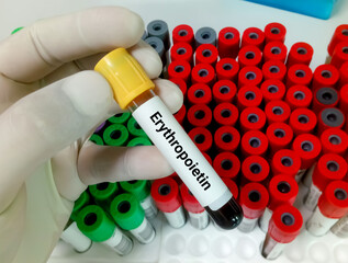 Wall Mural - Blood sample for Erythropoietin (EPO) test, stimulating hormone for RBC production