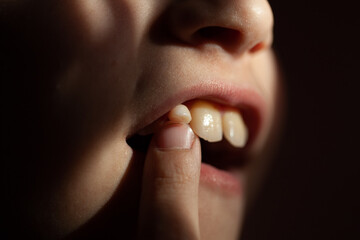 loss of a baby tooth in an eight-year-old child, at the last stage