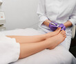 © Peakstock - Podiatrist doing treatment onychomycosis in patient's toenail using a medical laser. Woman having laser therapy on toenail