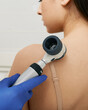 © Peakstock - Mole dermoscopy. Physician check-up of a patient's skin with a dermatoscopy for prevention of melanoma and skin cancer, close-up.