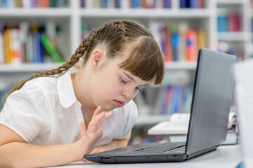 Young girl with syndrome down uses a laptop at library. Education for disabled children concept