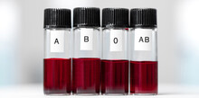 Samples With The Various Blood Types